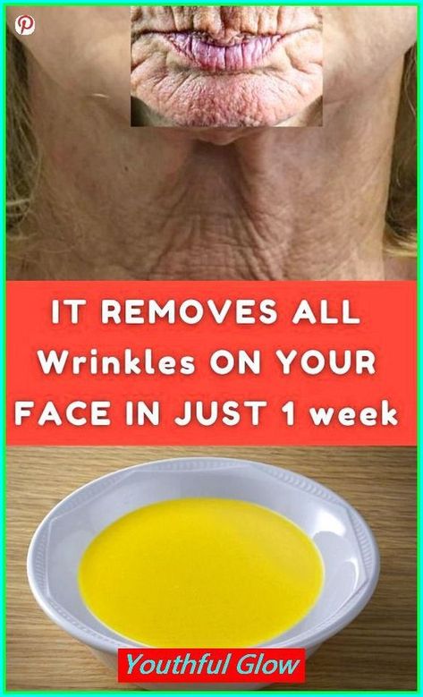 IT REMOVE ALL WRINKLES ON YOUR FACE IN JUTS 1 WEEK Wrinkle Remedies Face, Eyelid Wrinkles, Best Wrinkle Filler, Natural Wrinkle Remedies, Face Wrinkles Remedies, Home Remedies For Wrinkles, Wrinkle Prevention, Wrinkles Remedies Face, Mouth Wrinkles