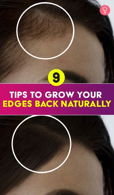 9 Tips To Grow Your Edges Back Naturally: How can you grow your edges back? This fragile hair needs extra care. If you continue over-handling them by wearing tight hairstyles like braids or weaves, they may break off and eventually cause hair loss. Grow Edges, Grow Hair Back, Hair Growth Methods, Thinning Edges, Stop Hair Breakage, Hair Growing Tips, Edges Hair, Hair Control, Hair Growth Tips