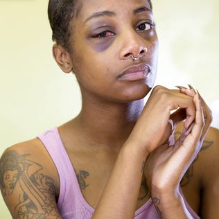 Seattle cop who punched handcuffed woman won’t face federal prosecution Eye Socket, Hurt Pain, Minds Eye, Black Eyes, African American Women, Eye Black, Police Officer, Black Lives Matter, Woman Face