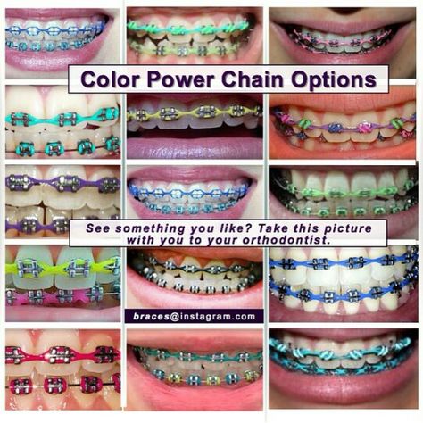 Color Power chains Brace Color Combinations, Braces Chain Colors, Cutest Braces Colors, Purple Power Chain Braces, Gold Braces With Color Bands, Silver Power Chain Braces, Power Chain Braces Colors, Braces Colors Ideas Power Chains, Braces Power Chain