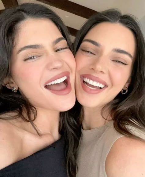 Kylie Jenner Teeth, Maquillaje Kylie Jenner, Looks Kylie Jenner, Trajes Kylie Jenner, Estilo Kylie Jenner, Kyle Jenner, Kylie Jenner Lipstick, Kendall Kylie Jenner, Kristen Jenner