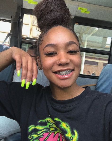 pinterest : @dabratzbby ‘ 🤍 follow for more pins! ✨ #braces Braces Ideas, Cute Braces Colors, Girls With Braces, Braces Tips, Braces Girls, Cute Braces, Brace Face, Braces Colors