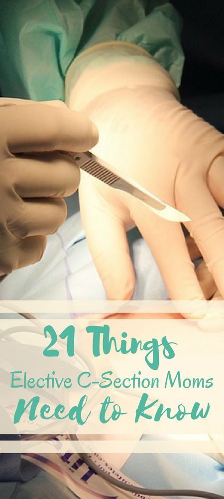 21 things that every elective c-section mom needs to know before the birth! Everything I wish I'd known before my two cesareans #csection #csections #cesarean #cesareans #caesarean #elcs #birth #babies #pregnancy #beprepared #momlife #mumlife #mom #pregna Cesarean Recovery, Elective C Section, C Section Scar, C Section Scars, Cesarean Section, Be Uncomfortable, Baby Care Tips, Give Birth, Mommy Blog