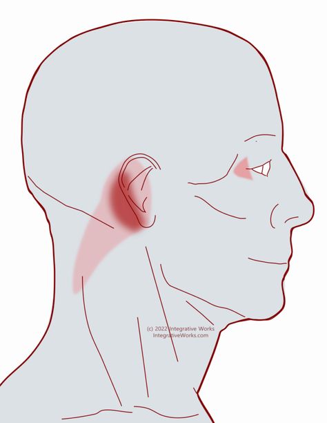 Pain Behind the Ear with Tension Down the Neck - Integrative Works Ear Congestion, Exercise For Hips, Best Exercise For Hips, Myofascial Pain Syndrome, Occipital Neuralgia, Face Massage Techniques, Ear Ache, Sore Neck, Spine Pain