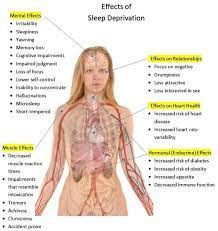 Sleep Deprivation All You Need to Know: Definition, Causes, Effects, And More! | Sleep Health Organ Trafficking, Sleep Deprivation Effects, Sinus Allergies, Human Body Organs, Muscle Twitching, Human Pictures, Increase Heart Rate, Human Body Parts, Sweat Gland