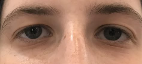 (1) Asian Hooded Eyes and Eyelash Extensions Asian Downturned Eyes, Hooded Eye Reference, Hooded Eyes Drawing Reference, Downturned Asian Eyes, How To Draw Downturned Eyes, Two Eyes Reference, Droopy Downturned Eyes Aesthetic, Hooded Eyes Reference, Droopy Eyes Reference