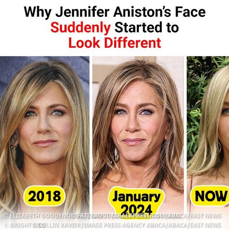 Jennifer Aniston Hair 2024, Jennifer Aniston Hair Styles, Jennifer Aniston Nose Job, Jennifer Aniston Nose, Jennifer Aniston Without Makeup, Jennifer Aniston Makeup, Jennifer Aniston House, Jennifer Aniston Haircut, Bad Celebrity Plastic Surgery