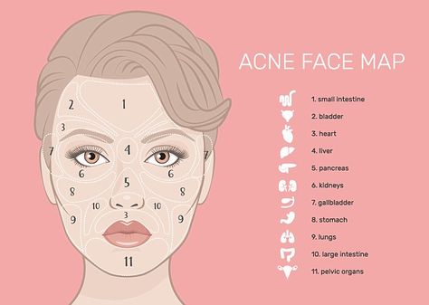 While aches and pains are common signs of illness, Emma has revealed how your face can be a reflection of your inner health too (stock image) Doterra Acne, Gesicht Mapping, Acne Face Map, Face Map, Face Mapping Acne, Pimples On Face, Face Mapping, Acne Face Wash, Natural Acne Remedies