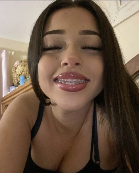 Lantinas Girl, Selfie Pretty Woman, Makeup With Braces, Pretty Girl Braces, Teeth Braces Aesthetic, Cute Braces Colors Aesthetic, Latina With Braces, Baddies With Braces, Light Pink Braces