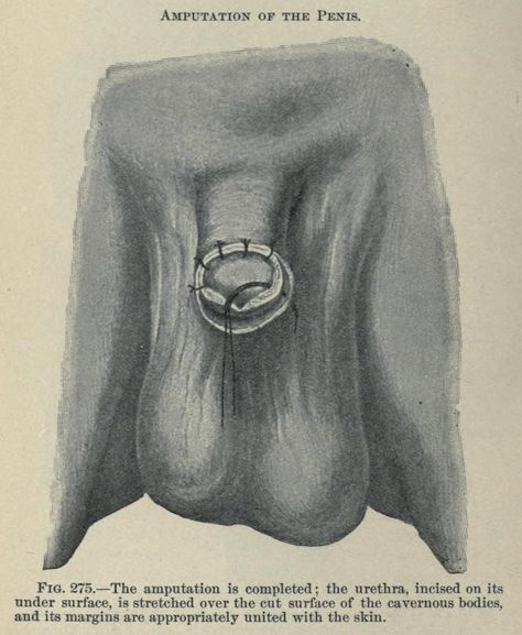 amputation procedures 1902 Vintage Surgery, Anatomy Diagrams, Abandoned Library, Surg Tech, Medicine Technology, The Catacombs, Vintage Medical, Nursing Notes, Scientific Illustration