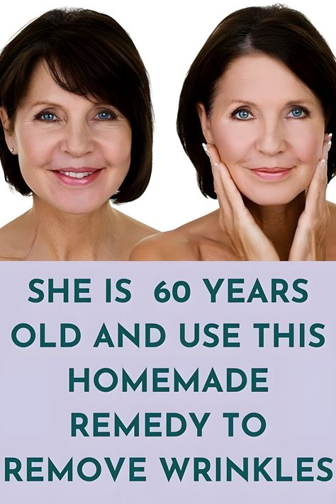 She is 60 years old and use this homemade remedies to remove wrinkles Anti Aging Remedies, Anti Aging Skincare Routine, Wrinkle Remedies, Wrinkle Free Skin, Skin Care Wrinkles, Face Wrinkles, Saggy Skin, Natural Anti Aging, Wrinkled Skin