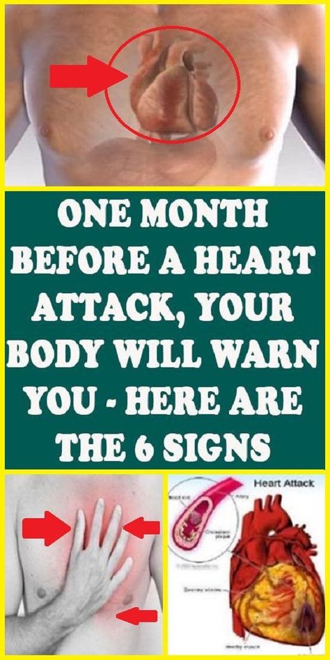 One Month Before a Heart Attack, Your Body Will Warn You – Here are the 6 Signs pinterest Healthy Tricks, Health For Women, Congenital Heart Defect, Health Women, Health Signs, Instant Pot Recipes Chicken, Daily Health Tips, Shortness Of Breath, Women Health