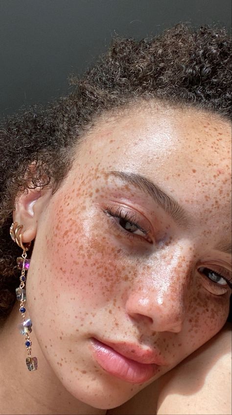 Freckles All Over Face, Glass Skin Freckles, Full Face Freckles, Glass Skin With Freckles, Clear Skin With Freckles Aethstetic, Beauty Marks Aesthetic, Bare Face Aesthetic, Freckles On Face, Tattoo Freckles