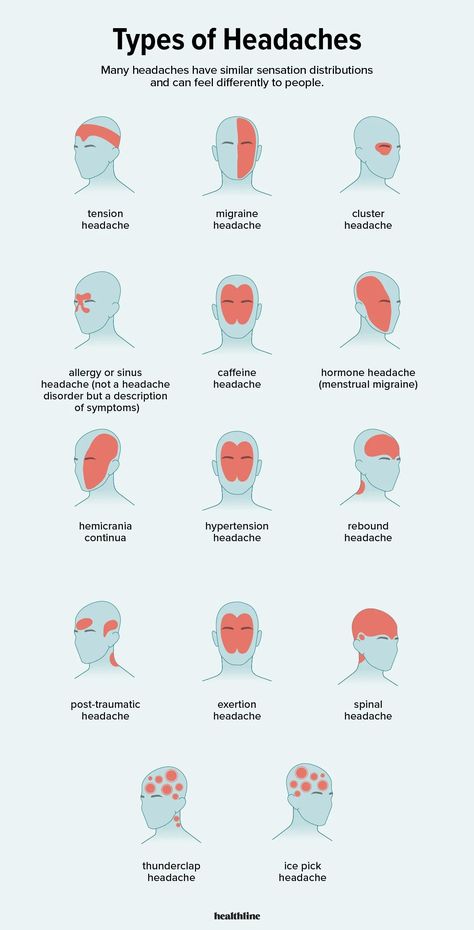 Types of Headaches: Symptoms, Causes, Treatments, and More Headache Types, Migraine Headaches, Medical Knowledge, Health Info, Health And Beauty Tips, Health Facts, Home Health, Useful Life Hacks, Massage Therapy