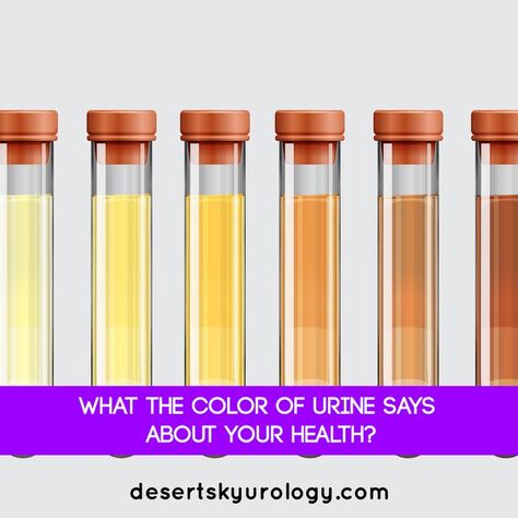 Color Of Urine Meaning, Color Of Urine, Cloudy Urine, Kidney Friendly Diet, Frequent Urination, Kidney Friendly, Color Meanings, Paper Work, Liver Health