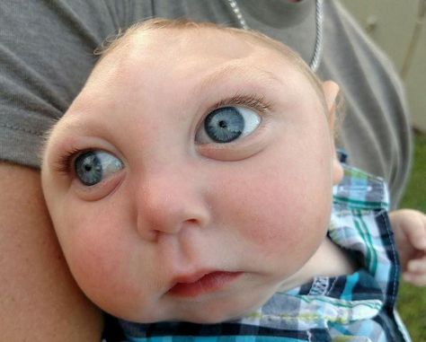 Jaxon Emmett Buell: Father of baby born with rare disorder responds to critics saying parents should have had abortion | Americas | News | The Independent Human Oddities, Baby News, Miracle Baby, Genetic Disorders, County Fair, Papa Francisco, Baby Born, Amazing People, Bbc News