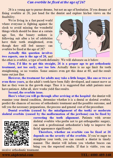 Can overbite be fixed at the age of 26? Actually this question involves two aspects, one is the age of 26, and the other is overbite, a type of teeth deformity. We will elaborate on it below. Fix Overbite, Dental Orthodontics, Orthognathic Surgery, Teeth Alignment, Facial Bones, Jaw Surgery, Life Struggles, Facial Nerve, Orthodontics Braces