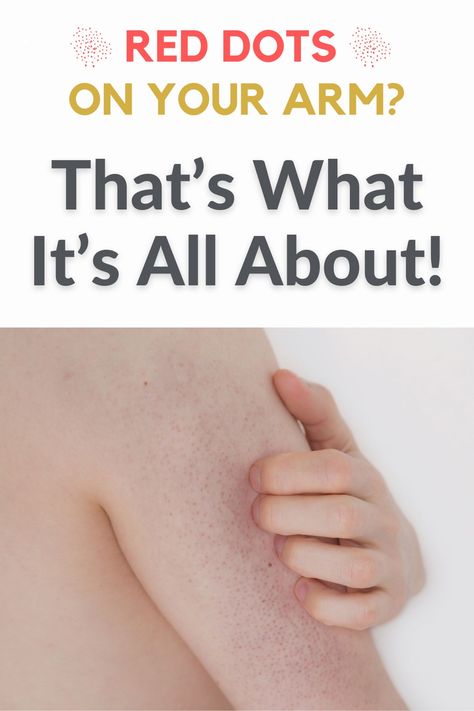 How To Get Rid Of Red Bumps On Arms, Small Bumps On Arms, Strawberry Arms, Bumpy Skin On Arms, Red Dots On Skin, Red Bumps On Arms, Arm Pimples, Red Spots On Face, Bumps On Arms