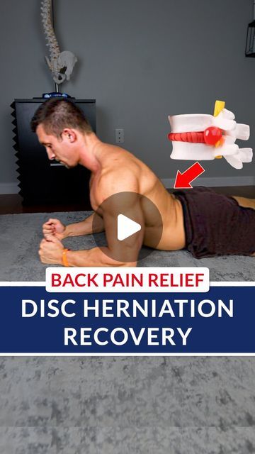 Dr. Grant Elliott on Instagram: "💥 Disc Herniation Recovery ❌ Have you been lifting and felt a POP in your low back? Now the next day you can barely stand up straight Or you find yourself actually crawling to the bathroom? This is a common disc herniation scenario our clients come to us with every week! Next thing you know you get an MRI, are referred for injections, and now you are looking at surgery…. This can totally be avoided! 🔑 This does resemble a classic disc herniation scenario, but you don’t have to follow the wrong path like most do. Instead, if you follow our approach you have a 97% chance of recovering WITHOUT SURGERY We talk to around 200 online clients a week with disc issues, and this process is a quick formula we created that will help most begin the recovery proc Workouts With Herniated Discs, L5 S1 Disc Herniation, Slipped Disk Relief, Herniated Disk In Lower Back Relief, Degenerative Disk In Lower Back, Herniated Disk In Lower Back, Disc Herniation, Stand Up Straight, Lumbar Disc