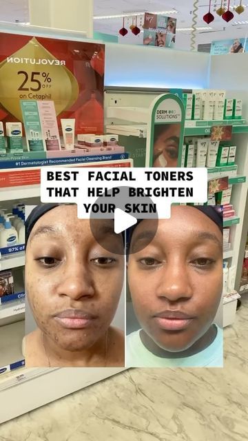 Rosemond Tettey on Instagram: "Best facial toners that helps brighten your skin!! #skincare #skincareroutine #facialtoner #clearskin #skincaretips #instagramreels #skintreatment #foryou #fyp #beautytips #skincareaddict" Best Toner For Combination Skin, Best Facial Toner, Rose Water Toner, Best Toner, Oily Face, Skin Redness, Skin Skincare, Toner For Face, Facial Toner