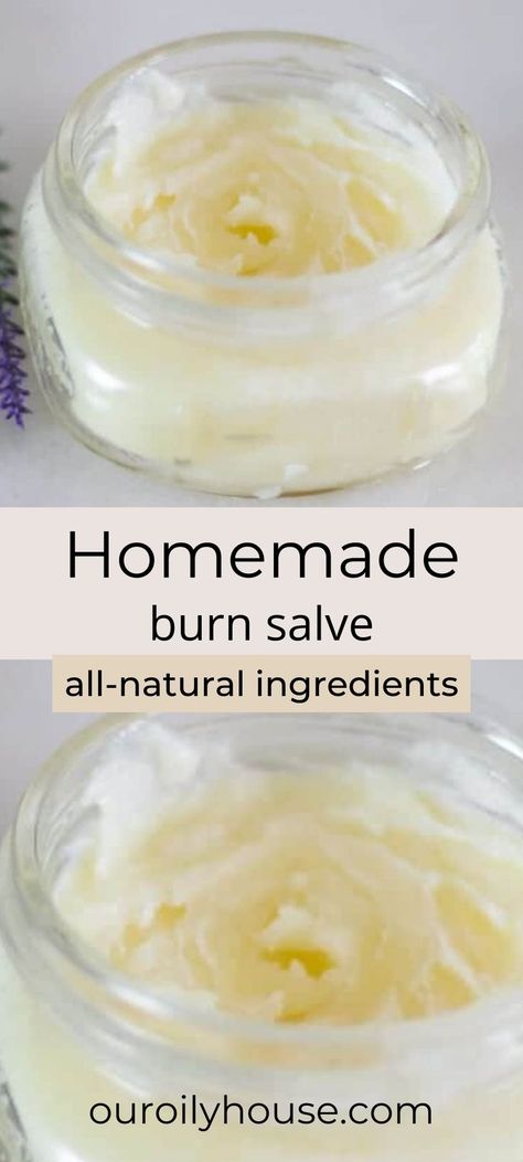 Burn Salve, Our Oily House, Burn Ointment, Salve Recipes, Cold Sores Remedies, Cleaner Recipes, Natural Sleep Remedies, Natural Cold Remedies, Natural Cough Remedies