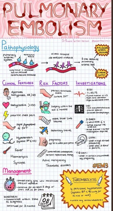 Pulmonary Embolism Infographic Pathophysiology Nursing, Paramedic School, Nursing Information, Nursing Mnemonics, Nurse Study Notes, Nursing Student Tips, Pa School, Cardiac Nursing, Nursing School Survival