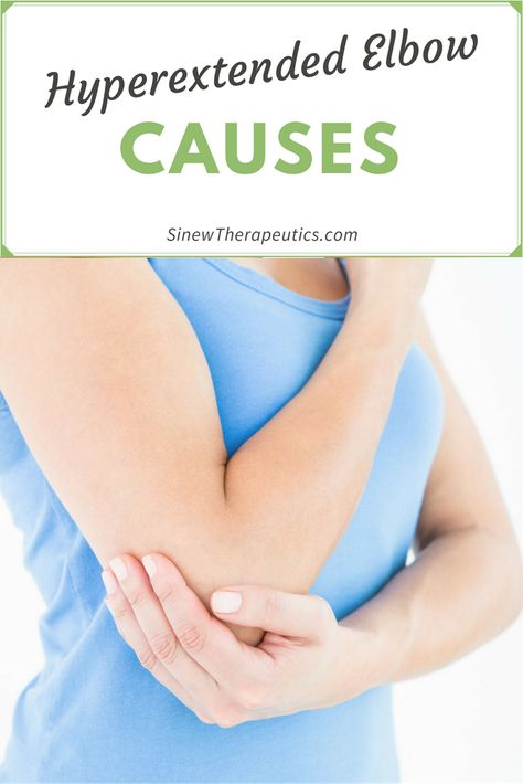 Causes of a Hyperextended Elbow Tennis Elbow Relief, Elbow Pain Relief, Tennis Rules, How To Play Tennis, Golfers Elbow, Tennis Pictures, Tennis Serve, Elbow Pain, Tennis Equipment