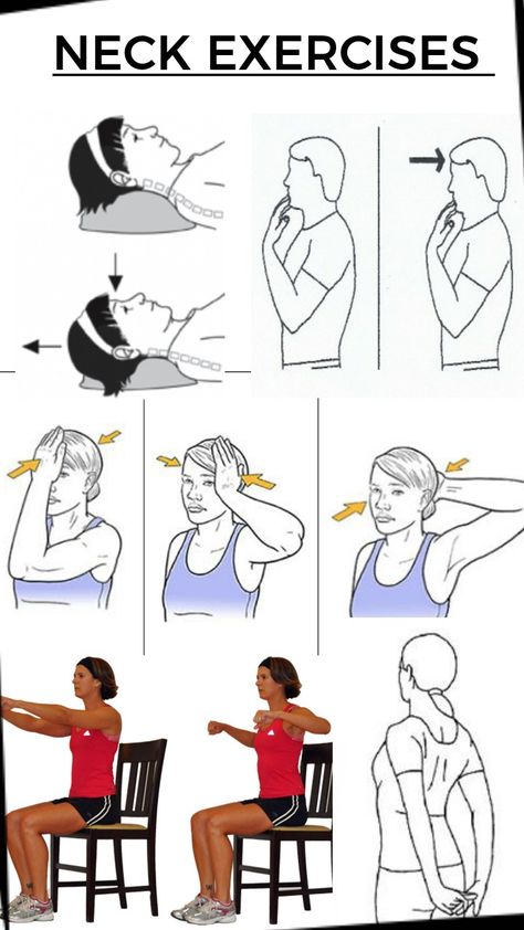 Effective exercise for neck pain and postural defects also good for cervical spondylosis . Cervical Neck Stretches, Exercise For Cervical Neck Pain, Neck Relief Stretches, Cervical Spondylosis Exercises, Neck Exercises For Pain Relief, Cervical Exercise, Cervical Exercises, Spondylosis Exercises, Cervical Pain Exercises