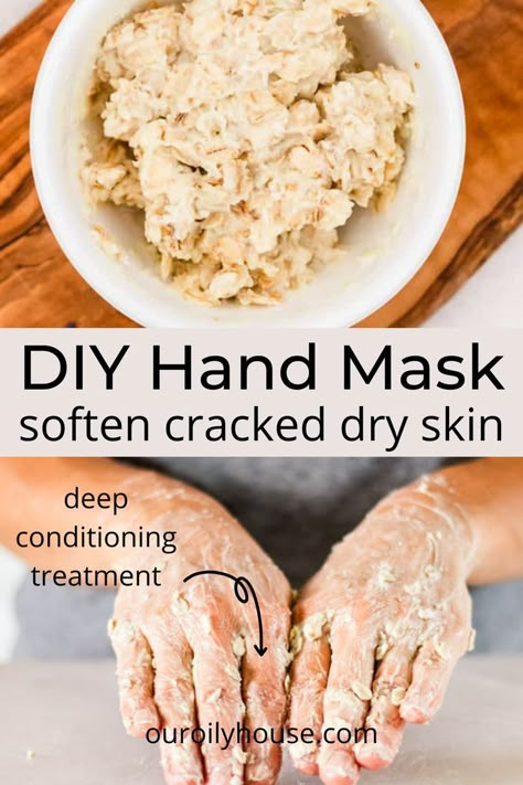 Diy Hand Mask Dry Skin, Diy Mens Skin Care, Diy Nail Mask, Diy Hand Lotion For Dry Hands, Diy Hand Cream For Dry Cracked Hands, How To Soften Hands Naturally, Remedy For Dry Hands, Parafin Hand Mask, Hand Soak For Dry Hands Diy