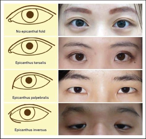 Epicanthic Fold, Draw Eyes, Drawing Eyes, Art Advice, Drawing Eye, Types Of Eyes, Face Drawing Reference, Human Anatomy Art, Anatomy Sketches