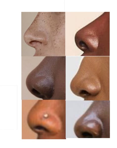 Good for reference practices Nose Study Reference Photo, Noses Reference Photo, Different Noses Reference, Flat Nose Reference, Nose Refrences Photography, Black Nose Reference, Art Reference Images, Noses Types, Cool Reference Photos For Artists