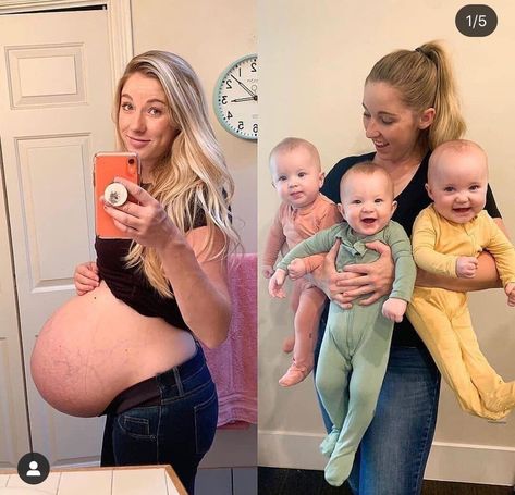 Pregnant With Triplets Belly, Triplet Pregnancy, Triplets Pregnancy, Big Pregnant, Princess Diana Dresses, Pregnancy Calendar, Human Physiology, Baby Bump Pictures, Bump Pictures