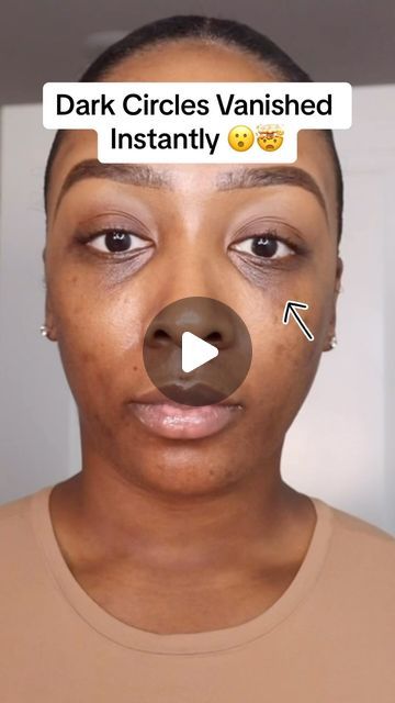 Kristen Green on Instagram: "Dark circles Vanished Instantly 😮🤯   After using the @elfcosmetics Putty Color Correcting Eye Brightner.   Makeup used in video👇🏾   @elfcosmetics Putty Color Correcting Eye Brightner Shade Rich   #darkcircles #darkcirclesundereyes #makeuphack" Dark Circles Under The Eyes Remedies, Under Eye Dark Circles, Dark Under Eye Circles, Dark Circles Makeup, Dark Circles Around Eyes, Dark Eye Circles, Under Eye Puffiness, Beauty Corner, Remove Dark Circles