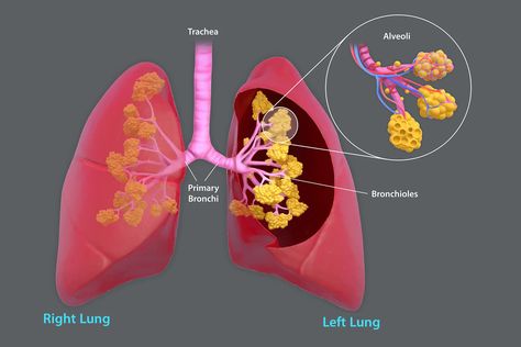 COPD (Chronic Obstructive Pulmonary Disease) Arterial Blood Gas, Lung Conditions, Reduction Surgery, Chronic Obstructive Pulmonary Disease, Pulmonary Disease, Genetic Disorders, Lung Disease, Shortness Of Breath, Respiratory