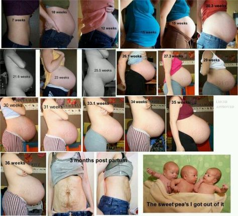 Amazing! Watch this mom's bump grow and shrink with her triplets! #triplets #multiples #bump Pregnant With Triplets Belly, 6 Week Baby, Twin Belly, Bump Progression, Baby Bump Progression, Triplets Pregnancy, Pregnancy Images, Pregnant Bellies, Multiples Baby