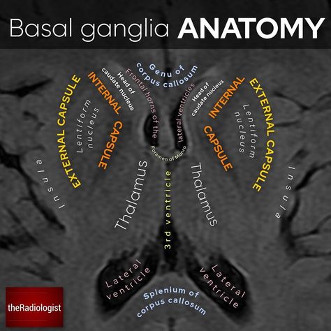 The Radiologist on Instagram: “Improve your knowledge of brain imaging with this MRI FLAIR sequence image at the level of the basal ganglia and thalami ⁣ ⁣ 👨🏽‍💻I found…” Basal Ganglia Anatomy, Neurology Nursing, Medical Radiography, Mri Brain, Medical Ultrasound, Radiology Student, Basal Ganglia, Radiology Imaging, Brain Images