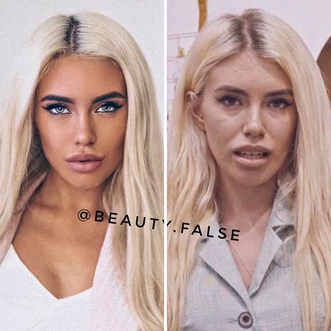 24 Ladies Exposed on Instagram for Their Fake Looks. - Wtf Gallery Photoshop Vs Reality, Women Without Makeup, Reality Vs Instagram, Celebrity Makeup Transformation, Insta Vs Reality, Real Women Bodies, Instagram Vs Real Life, Instagram Vs Reality, Nobody Is Perfect