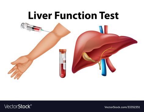 Bilirubin Levels, Prothrombin Time, Quadrants Of The Abdomen, Test Posters, Liver Function Test, Education Vector, Education Illustration, Heart Diet, Bone Diseases