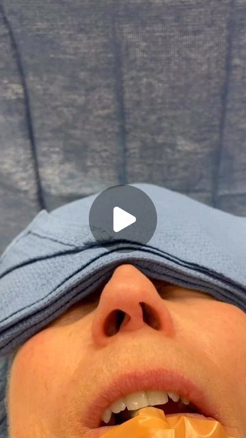 Dr. Richard Reish, M.D., FACS on Instagram: "Revision rhinoplasty in the operating room:  This patient’s previous surgery left her with significant columella and nostril asymmetry. This was all due to poor tip support. By creating more appropriate tip support, symmetry can be improved significantly. It is important to note that no result will ever be perfect, but we can make significant improvements with revisional surgery. .
.

Please feel free to contact my office for a complimentary  consultation at 212-879-8506. .
.

My personal Bio, full gallery of before and after pictures, and a list of procedures I perform can be found at the link on my Instagram homepage. .
.

This is my actual patient with real results who has given informed consent to appear on my website and social media pages. Nasal Tip Rhinoplasty, Revision Rhinoplasty Before After, Rhinoplasty Before After, Revision Rhinoplasty, Plastic Surgery Pictures, Personal Bio, Rhinoplasty Before And After, Rhinoplasty Surgery, Informed Consent