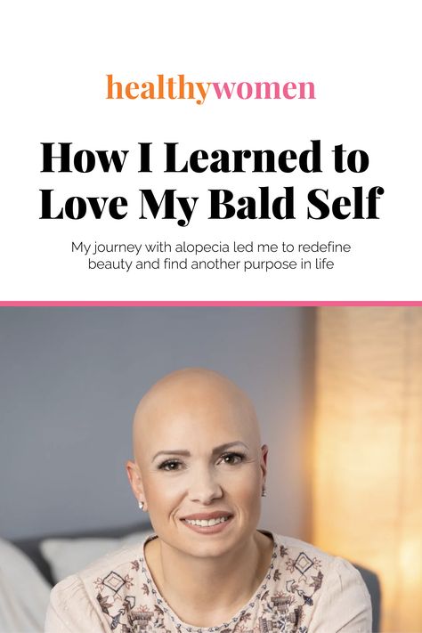 When McKenna’s hair started falling out, she felt like she was losing her identity. As a healthy mother of two children, she thought the sudden hair loss was due to postpartum shedding, but as it got worse, she saw d was diagnosed with #alopecia, an autoimmune disease that affects 7 million people in the U.S. Support from her family and her desire to be strong for her children helped McKenna find empowerment in her diagnosis. Check out her story: https://bit.ly/3rgG8cZ Androgenic Alopecia In Women, Androgenic Alopecia, Ap Psychology, Bald Patches, Inspiring Others, Mother Of Two, Purpose In Life, Stimulate Hair Growth, Hair Starting