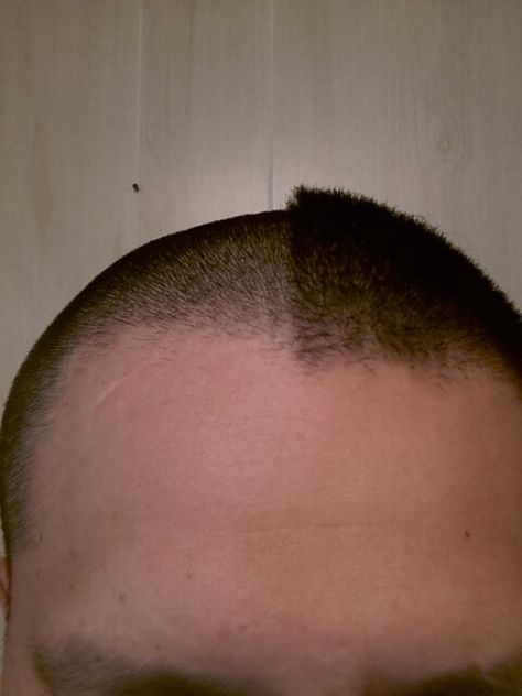 I shave my hair down with a #1 guard every 2 weeks. This is halfway through after 16 days. Thanks Wahl. Sorry everyone who gets paid to cut hair. Number One, Down Hairstyles, Hair Cuts, Thing 1, Hair