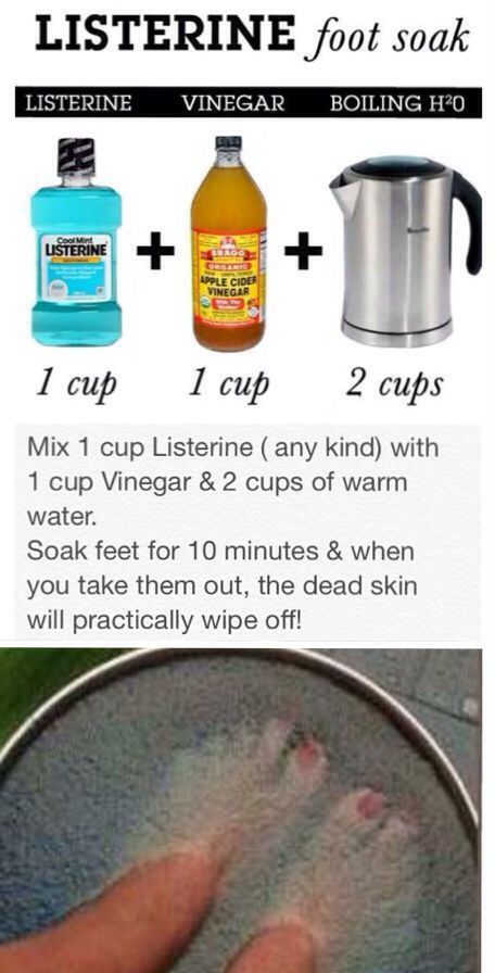 Vegan Broccoli Salad, Listerine Foot Soak, Waldorf Salad Recipe, Foot Soak Recipe, Treat Hyperpigmentation, Vegan Broccoli, Get Rid Of Pimples, Waldorf Salad, Rid Of Pimples