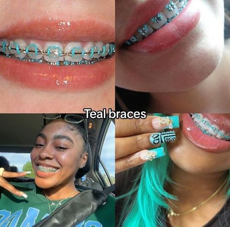 Braces With Crooked Teeth, Braces Color Power Chain, Braces Combo Colors, Stitch Braces, Cute Braces Colors Ideas, Light Green Braces, Teal Power Chain Braces, Aqua Braces, Teal Braces On Black People