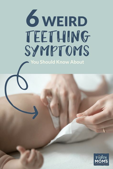 Baby Teething Remedies, Teething Symptoms, Baby Remedies, Baby Development Activities, Sleep Hacks, Teething Remedies, Teething Babies, Newborn Baby Care, Teething Baby