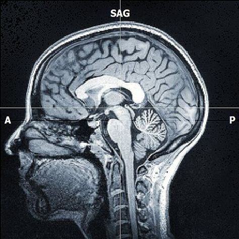 Psychology Neuroscience, Brain Psychology, Brain Mri, Psychology Experiments, Neuroscience Art, Mri Brain, Glasgow University, Brain Anatomy, Brain Art