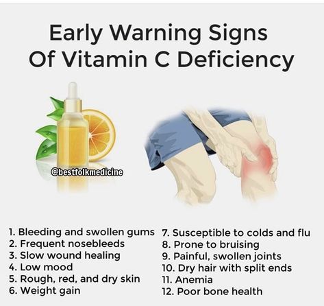 Vitamin C Deficiency Symptoms, Black Currents, Spice Benefits, Vitamin C Deficiency, Herb Remedies, Herb Book, Health Posts, Mineral Nutrition, Deficiency Symptoms