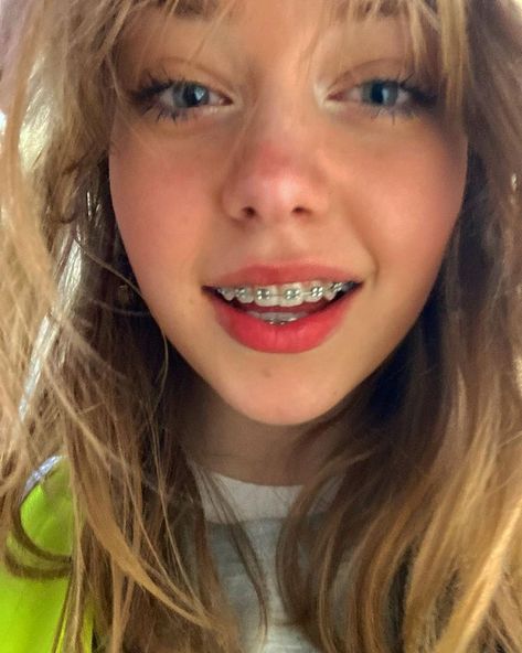 lily pearl crosland 🤍 en Instagram: “i had such a long day today” Girl With Braces, Girls With Braces, Braces Smile, Cute Braces Colors, Braces Tips, Getting Braces, Braces Girls, Cute Braces