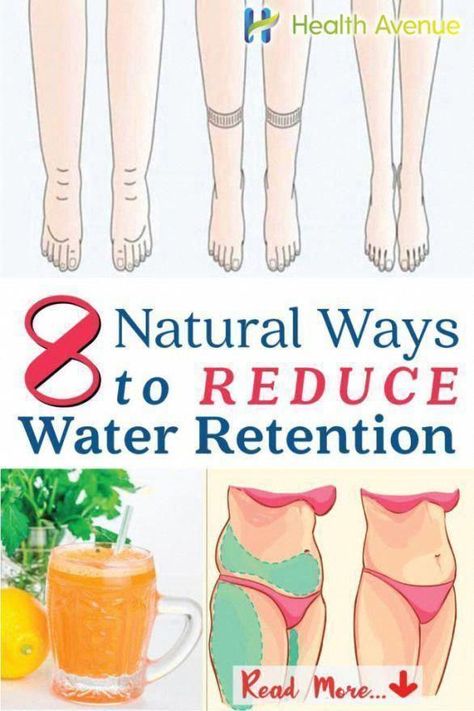 8 Natural Ways to Reduce Water Retention #reduceweight #HealthTips #HealthAdviceLine #NaturalRemediesImpetigo #AsthmaNaturalRemedies #HealthyFoodForHealthyLife #HealthMagazine How To Reduce Water Retention, Reduce Water Retention, Water Retention Remedies, Water Retention, Hot Flashes, Health Magazine, Health Advice, Reduce Weight, Dull Skin