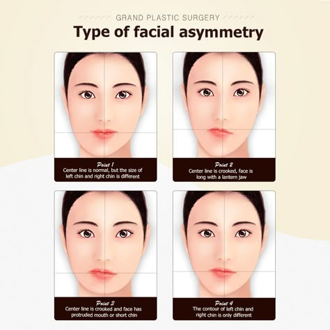 Exercise For Assymetrical Face, Makeup For Asymmetrical Face, Makeup For Assymetrical Face, Hairstyles For Asymmetrical Faces, Asymmetrical Face Aesthetic, Assymetrical Face Aesthetic, Assymetrical Face Exercise, Unsymmetrical Faces, Types Of Smiles