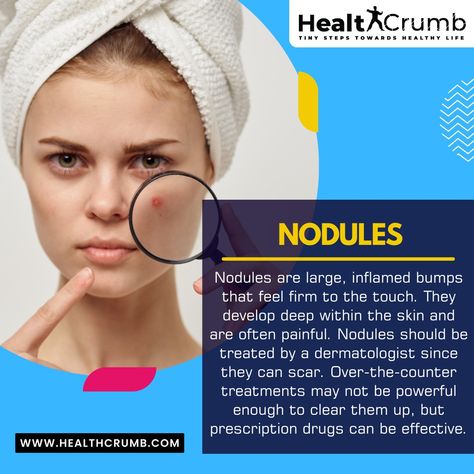 Nodules . . . . . #healthcrumb #health #skincare #acne #nodules #skinhacks #remedy #homeremedy #regime #routine #hacks #healthylifestyle Nodule Acne, Tiny Steps, Skincare Acne, Skin Tips, Home Remedies, Healthy Life, Healthy Lifestyle, Acne, Feelings